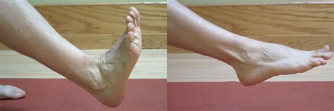 Ankle Sprains – Intermediate Phase (Part II of III) | The Physical Therapy Advisor