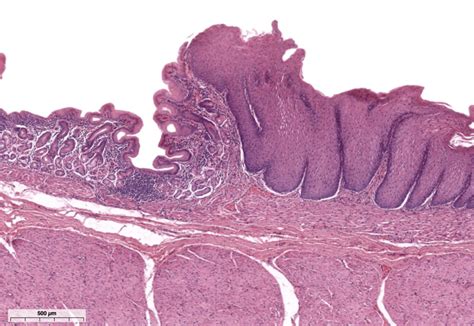 Gastroesophageal Junction Histology Diagram | Quizlet