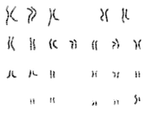 Whole genome sequencing - Wikipedia