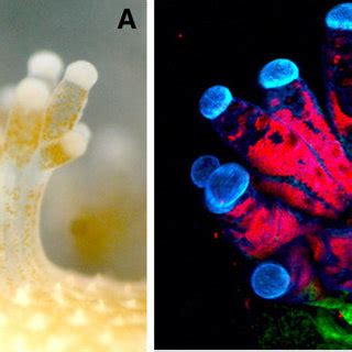 Coral polyps in symbiosis. (A) Light micrograph of an Acropora ...