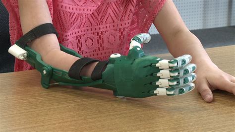 3D Printing Prosthetics | 3d printing, Prints, Health technology