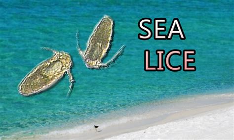 Beware of SEA LICE this SUMMER | WZNS-FM