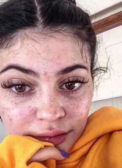 Kylie Jenner No Makeup Photos - focistalany