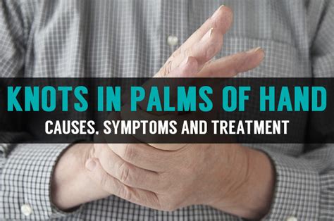 Knots and Lump in Palm of Hands | Symptoms & Home Treatment