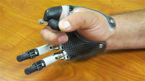 Mechanical Partial Hand Prostheses