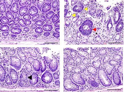 New potential treatment for graft-versus-host-disease and other ...