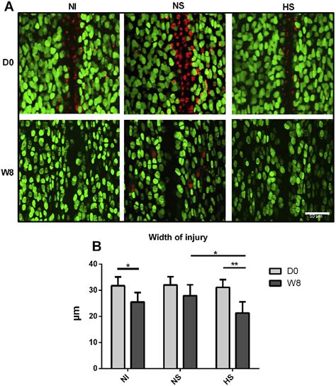 Figure 5 from The use of hyperosmotic saline for chondroprotection: implications for orthopaedic ...