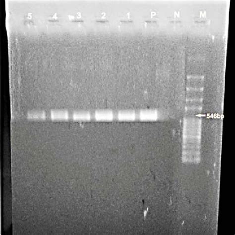 Agarose gel with the products of PCR amplification of genotype PCV2a ...