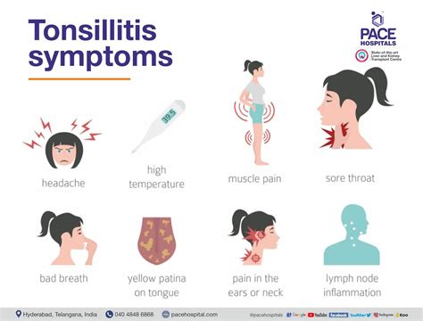 Adenotonsillitis - Symptoms, Diagnosis and Treatment