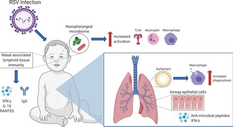 Severe respiratory syncytial virus disease in preterm infants: a case of innate immaturity | Thorax