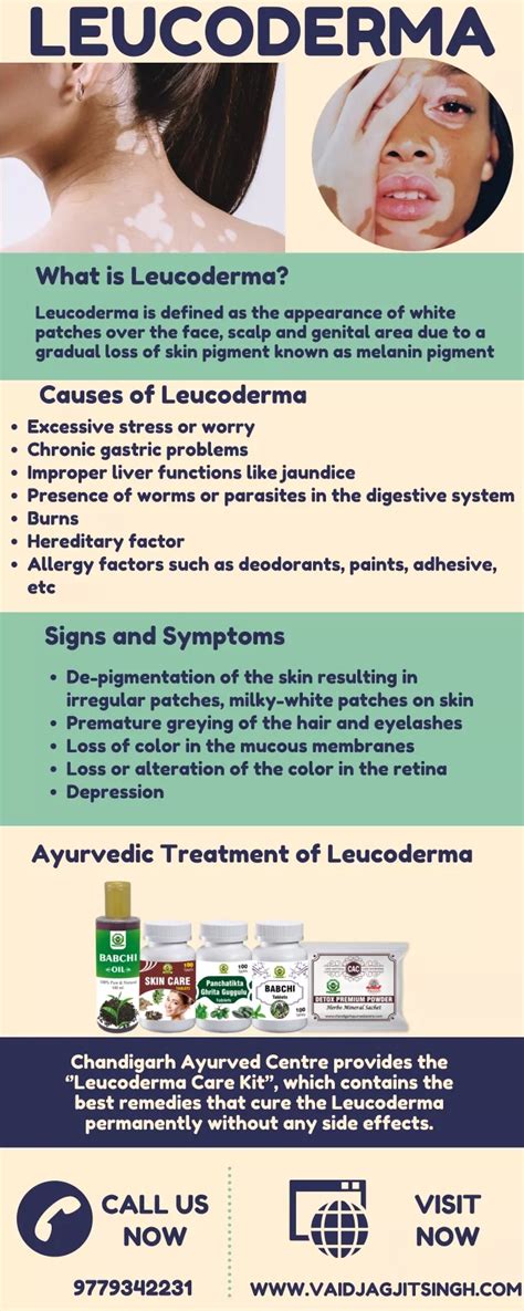 PPT - Leucoderma - Causes, Symptoms and Herbal Treatment PowerPoint Presentation - ID:10111520