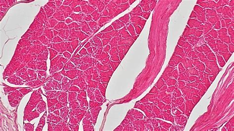 Muscle Tissue: Cross Section Whole Skeletal Muscle | Flickr