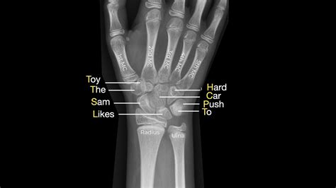 Wrist Examination & Pathology Module - Don't Forget the Bubbles