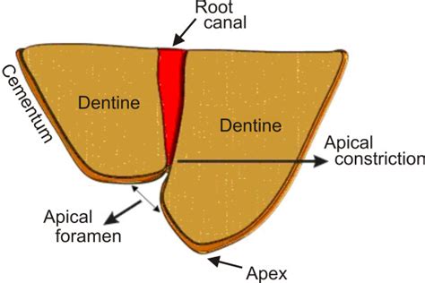 Apical limit and working length in Endodontics by Stephane Simon et al. 2009 | Key Topics in ...