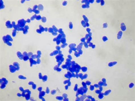 Microscopic image of a Malassezia spp. culture. Methylene blue staining. | Download Scientific ...