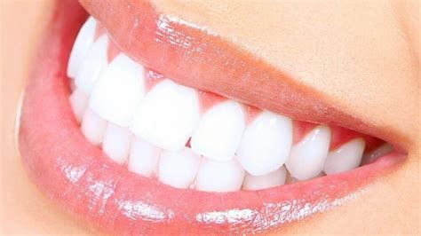 Glam Smile Studio Laser Teeth Whitening - 55 Fennel Way Fairmoor ...