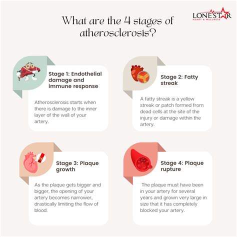 Arteriosclerosis: Symptoms, Causes, and Treatment in Waco, TX