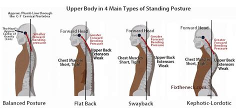 weak-upper-back-muscles – Fitness Workouts & Exercises