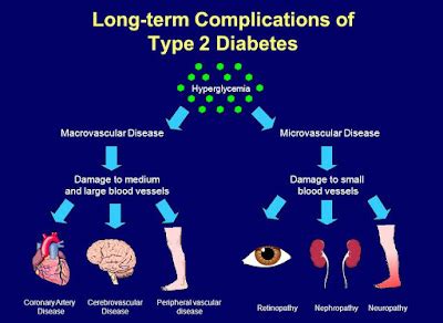 Complications Of Type 2 Diabetes - Health And Medical Information