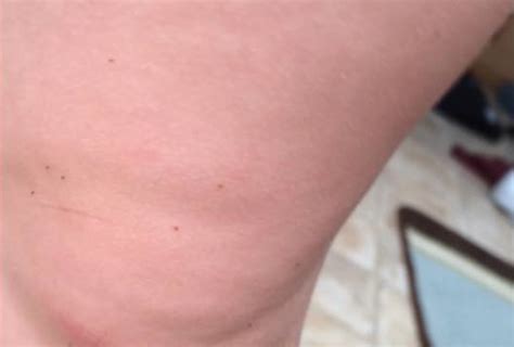 Mom shares terrifying photos of 3-year-old covered in "seed ticks" - CBS News