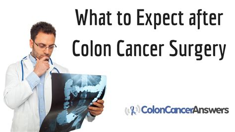 What to Expect after Colon Cancer Surgery - YouTube