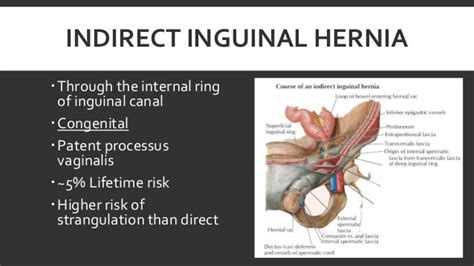 Diagram Of Womans Groin Area Inguinal Hernia Anatomy Female Anatomy | Images and Photos finder