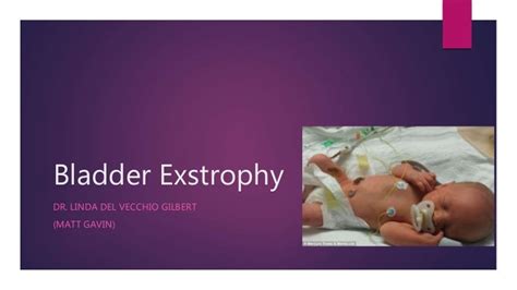 Bladder exstrophy