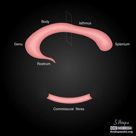 Corpus Callosum Parts