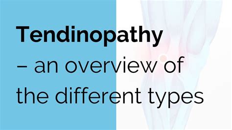 Tendinopathy - an overview of the different types - Sports Injury | Online