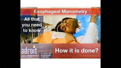 Esophageal Manometry: How Is It Done? Ahmedabad, Gujarat,, 56% OFF