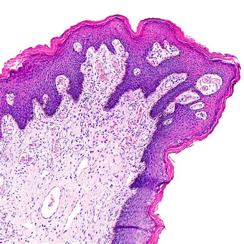 Hematoxylin and Eosin Staining Kit - Teomics