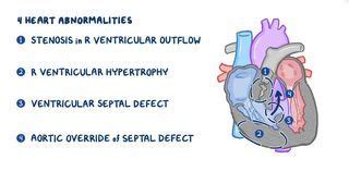 Knee-Chest Position: What Is It, Uses, and More | Osmosis