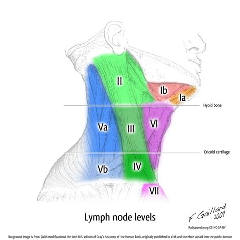 Cervical lymph node diagram - Clinical Guide Wiki