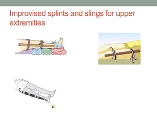 Splinting in first aid