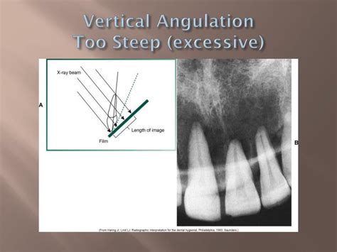 PPT - The Bisecting Technique PowerPoint Presentation - ID:2337946