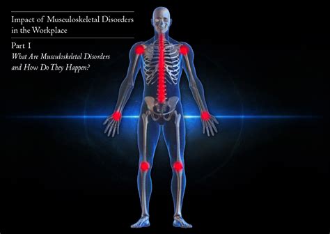 What are Musculoskeletal Disorders and How Do They Happen?