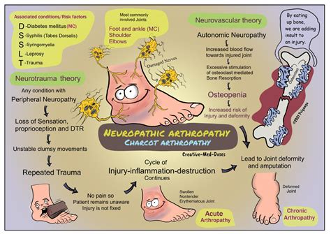 Neuropathic arthropathy: Charcot arthropathy - Creative Med Doses