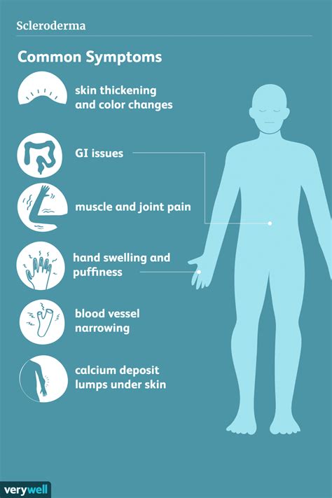 Scleroderma: Signs, Symptoms, and Complications