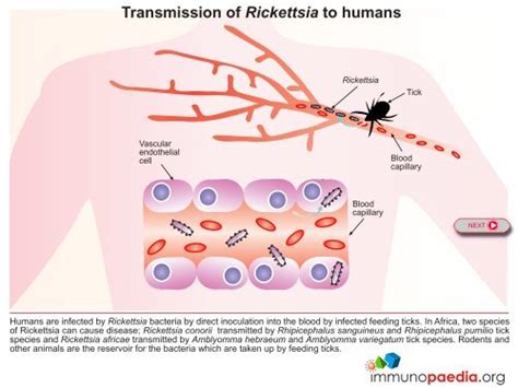 Transmission of Rickettsia to humans - Immunopaedia