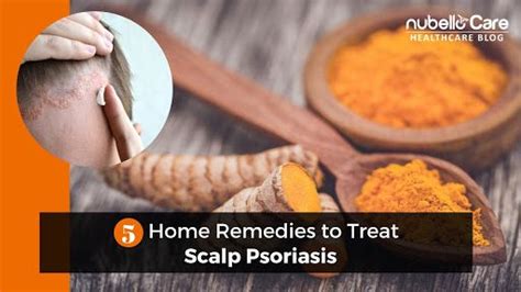 Treat Scalp Psoriasis, One of The Common Skin Condition at Home with ...