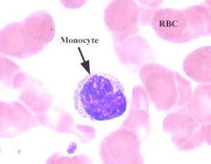 Monocytes High Levels, Causes