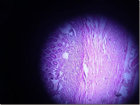 Histology Slides Database: Acute Appendicitis Histopathology