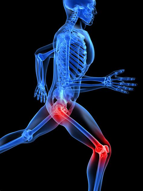 Rheumatoid arthritis mechanisms may vary by joint | National Institutes of Health (NIH)