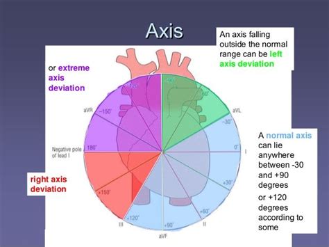 Determining Right or Left Axis Deviation | Basic anatomy and physiology, Cardiovascular nursing ...