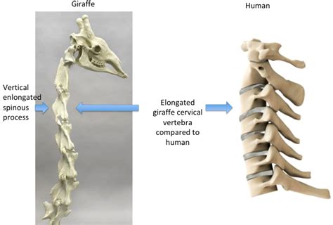 How Many Vertebrae Do Giraffes Have in Their Body