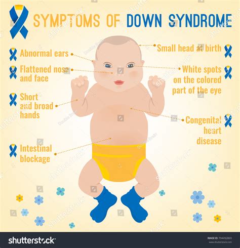 Symptoms Down Syndrome Poster Abnormal Ears: เวกเตอร์สต็อก (ปลอดค่า ...