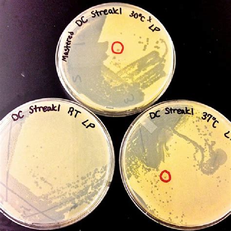 Bacterial Streak Plate