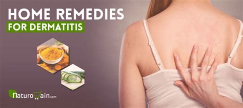 10 Best Home Remedies for Dermatitis to Prevent Eczema Scars [Fast]