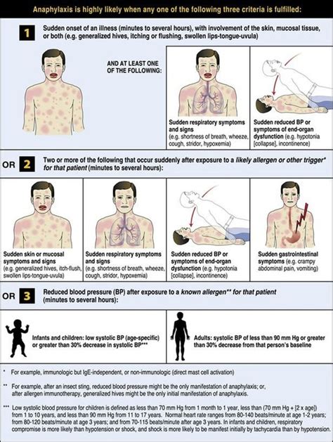 Anaphylaxis: Diagnosis - PEDIATRIC ANAPHYLAXIS