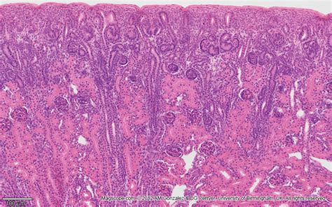 Kidney Renal Cortex Histology